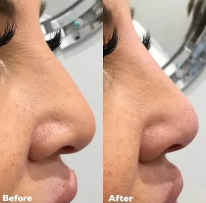 Aesderma Med Spa