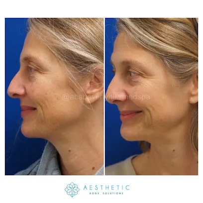 Aesthetic Body Solutions