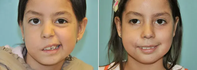 Andre Panossian, MD, Plastic Surgery