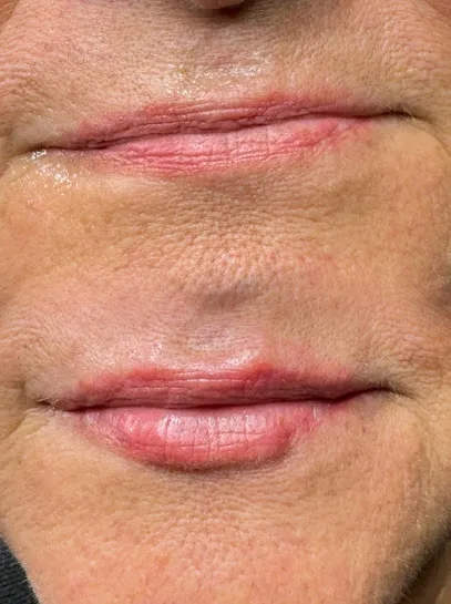Brows, Lips & Esthetics by Monica