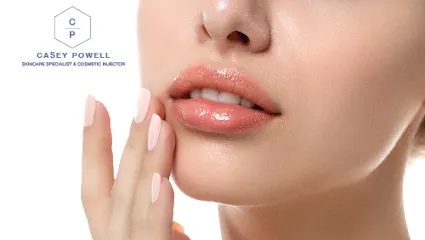 Casey Powell PA Aesthetic Injector & Skincare Specialist