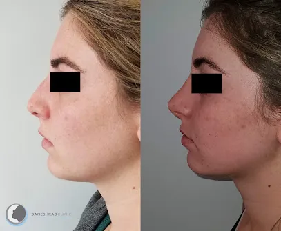 Daneshrad Clinic ENT and Facial Plastic Surgery in Santa Monica and Los Angeles