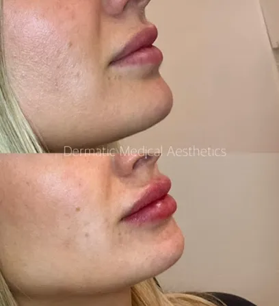 Dermatic Medical Aesthetics