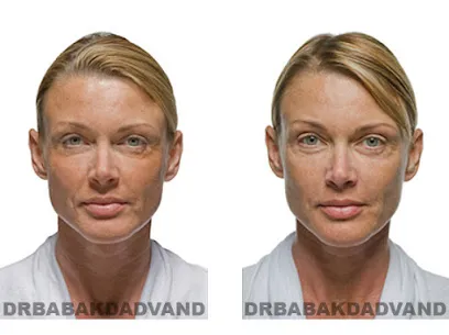 Dr. Babak Dadvand