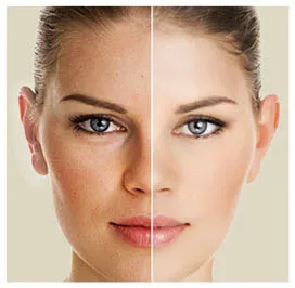 Dr. Keith Marcus Facial Plastic Surgery