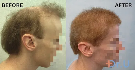 Dr. U Hair and Skin Clinic