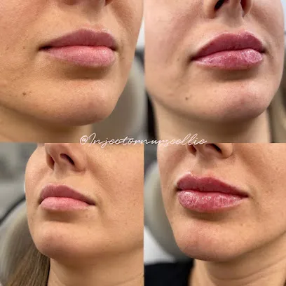 Ellie Lambert MSN FNP-BC | Aluma Medical Aesthetics