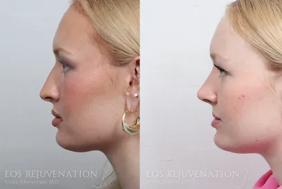 Eos Rejuvenation Rhinoplasty Center - Dr. Nima Shemirani