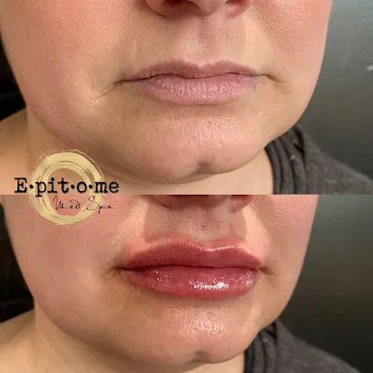 Epitome Med Spa