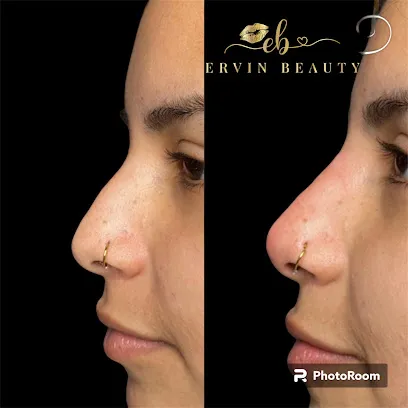 Ervin Beauty