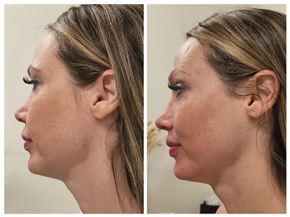 FACECO Buccal Facial