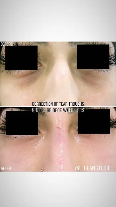 Glam MediSpa
