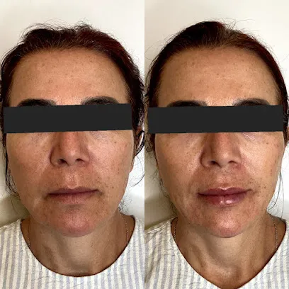 Gunn Medical Aesthetics