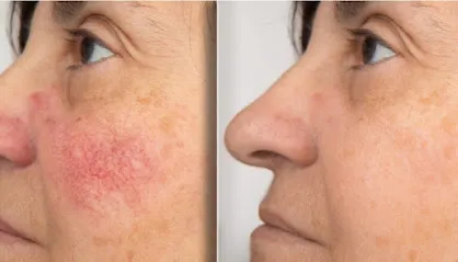 Hush LA Medspa