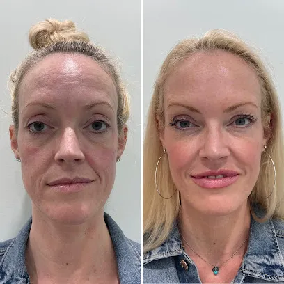 Kalologie Medspa | Santa Monica