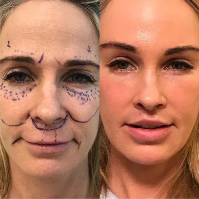 Kao Plastic Surgery