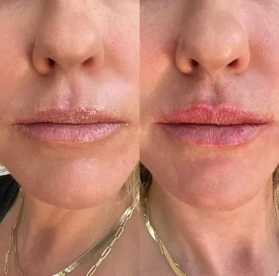 LA Ageless Medical Aesthetics