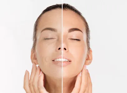 LA Esthetique(Clinical Aesthetics)-Brentwood/Beverly Hills