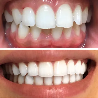 Maryam Hadian, DDS | Le Chic Dentist Los Angeles, CA