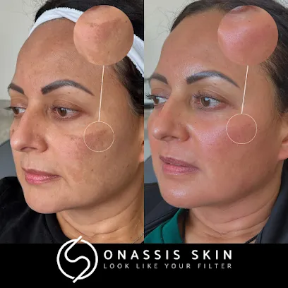 Onassis Skin