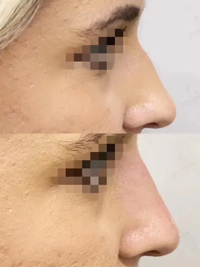 PICO 医美 -PICO Clinic Beverly Hills