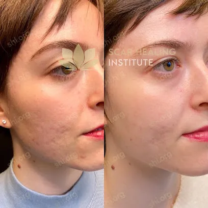 Scar Healing Institute - Best Acne Scar Treatment Center