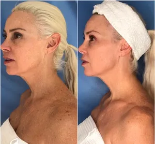 SILK, A Medical Spa