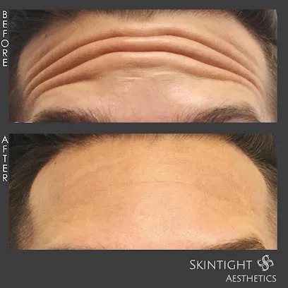 SkinTight Aesthetics