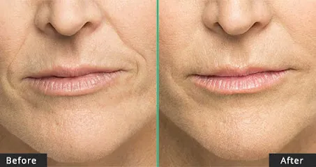 Tarzana Cosmetic Wellness & Medspa