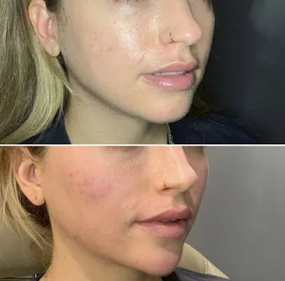 V Sculpt Aesthetics