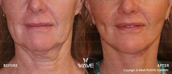 Wave Plastic Surgery & Aesthetic Laser Center