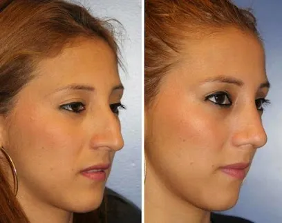 Westside Face - Dr. Behrad Brad Aynehchi